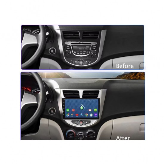 9 inch Android cassette Hyundai - RB- Apple CarPlay