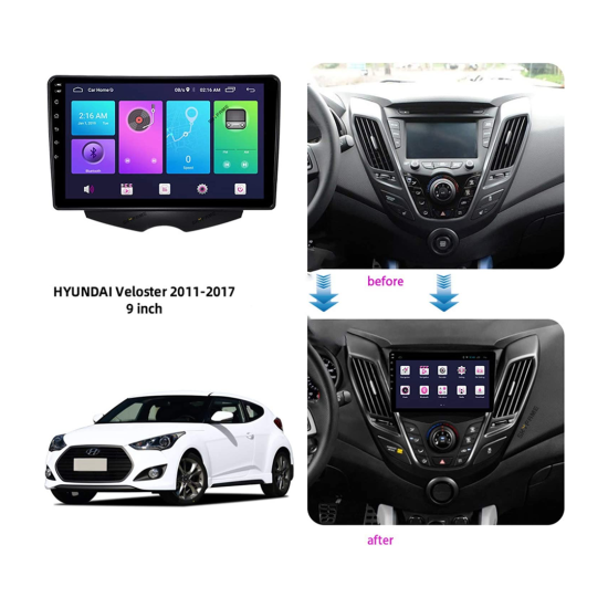 Android screen for Hyundai Veloster, 2GB RAM, 32GB memory